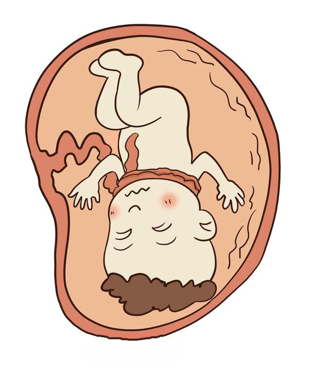 脐带有问题会影响孩子吗,脐带供血不足对胎儿的影响