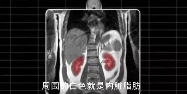 五个真正有用的减肥方法亲测有效,14条减肥的建议看完再开始减肥