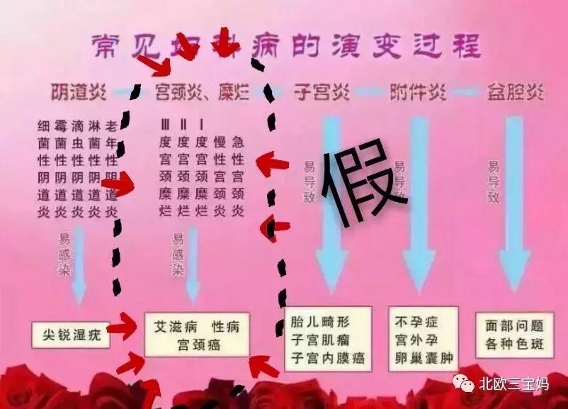 宫颈病变到宫颈癌还差几步,宫颈糜烂发展到宫颈癌要多久