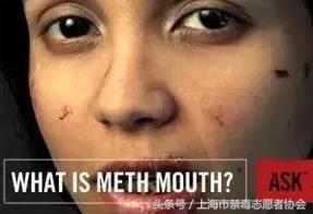 毒言毒语大全,一口烂牙你们郁闷吗