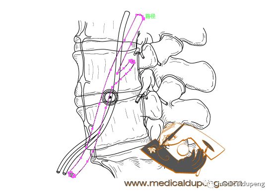 医学插画插图,医学插画sci