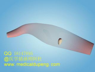 医学插画插图,医学插画sci