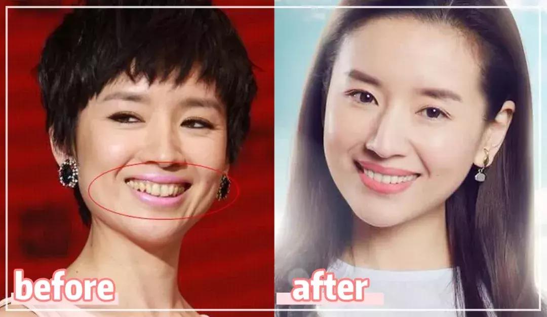 囧！天仙脸配上大黄牙，这是什么操作？！