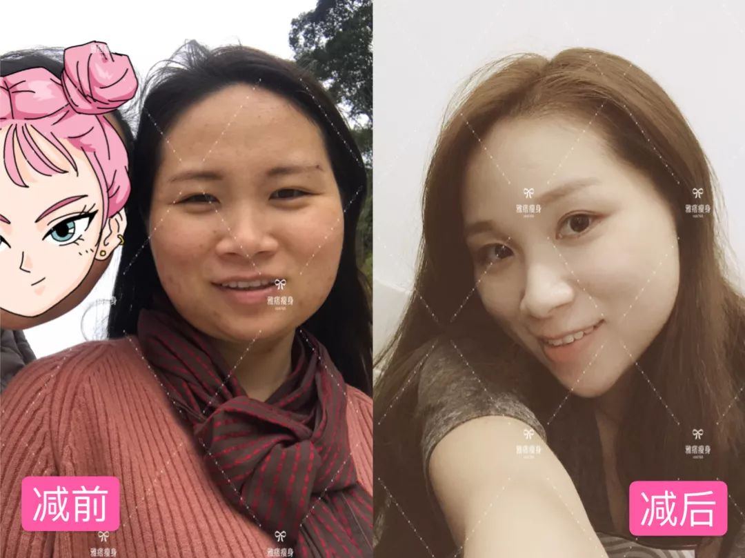 一个月瘦15斤的秘诀管住嘴迈开腿,管住嘴迈开腿瘦到90斤