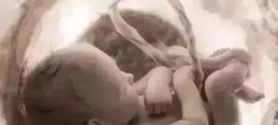 羊水为什么叫羊水秒懂知识,12周羊水什么样子