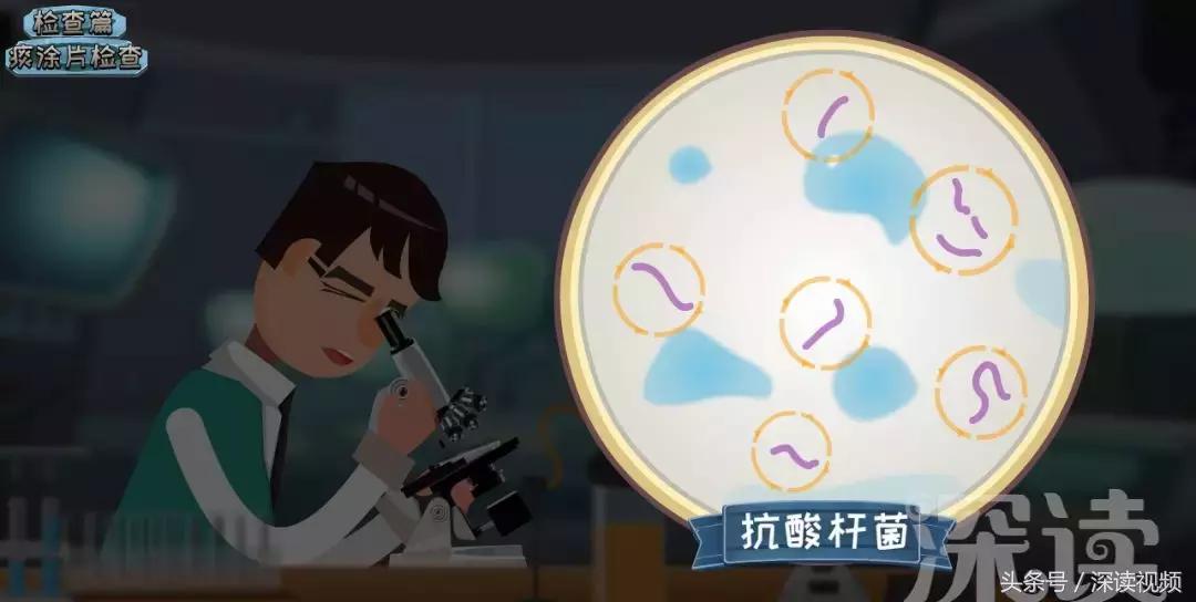 咳嗽低烧37.1-37.5要警惕,咳嗽低烧警惕四种病