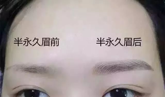 眉毛多有没有必要做眉毛,眉毛做不好看了还能改吗