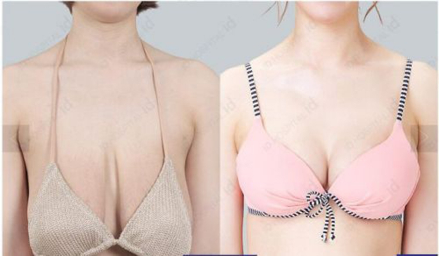 女人生完宝宝后，这4个部位最“受损”，若不护理，与年轻“无缘”