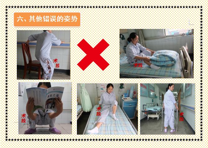 人工股骨头置换术术后教学查房,人工髋关节置换术后护理注意事项