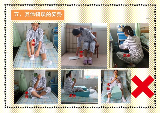 人工髋关节置换术前准备护理,人工髋关节置换术的健康宣教手册