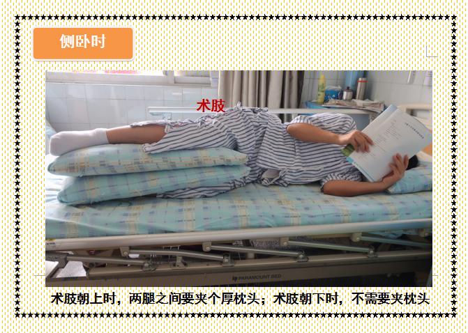 人工髋关节置换术前准备护理,人工髋关节置换术的健康宣教手册