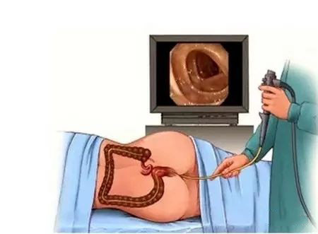 胃镜检查胶囊内镜好吗,胃镜胶囊胃镜钡餐有什么区别