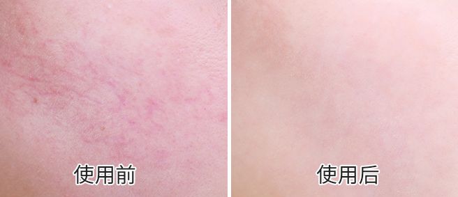 充电10分钟，水嫩一整天！这盒澳洲“断货王”面膜也太好用了吧！