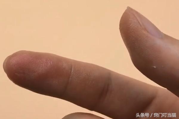 手指被502胶粘了该怎么快速解开,手指和手指被502胶水粘住了怎么办