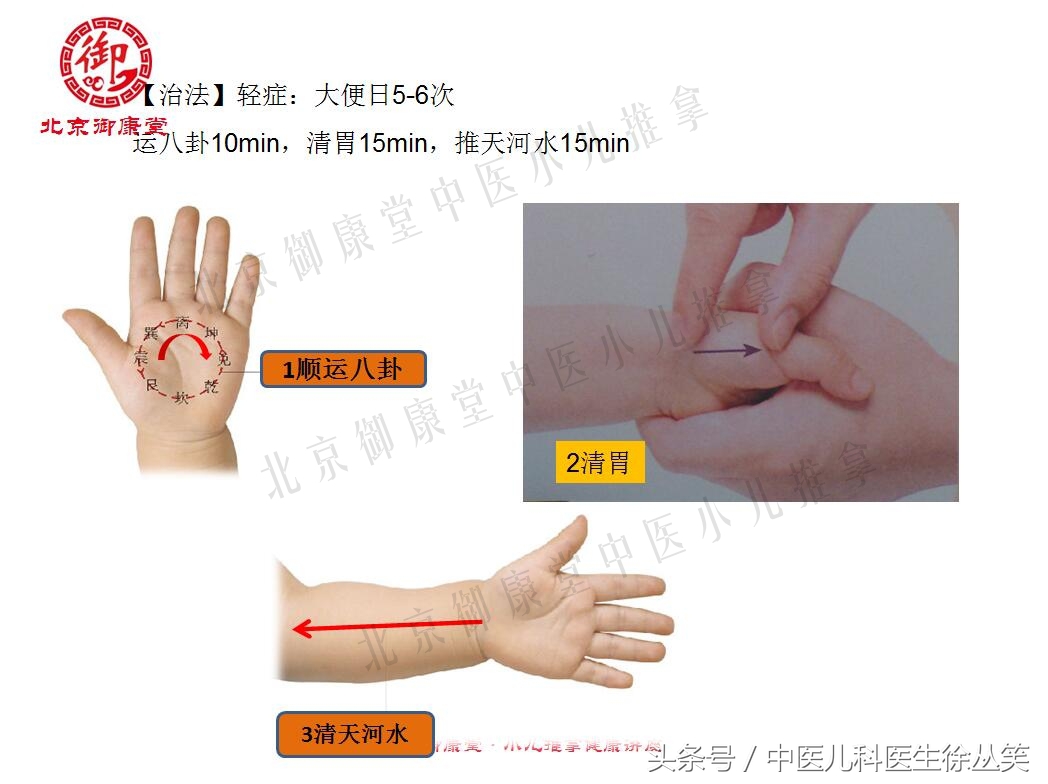 小儿腹泻中医按摩的方法,小儿秋季腹泻推拿常用手法