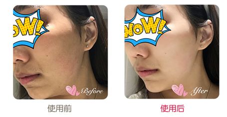 有了全世界3秒卖一瓶的“液体黄金“，干燥、长痘就与你无缘了！