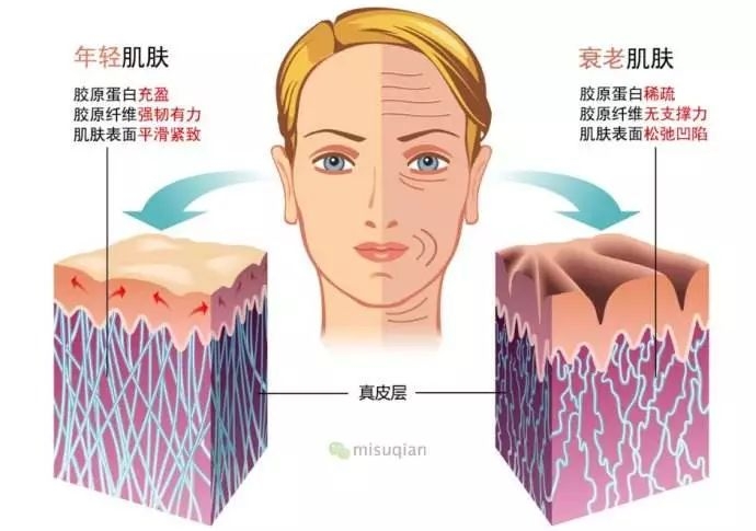 微商胶原蛋白是真的吗,微商胶原蛋白骗局揭秘