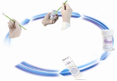 HPV和TCT检查报告出来怎么看,宫颈hpvtct检查报告单