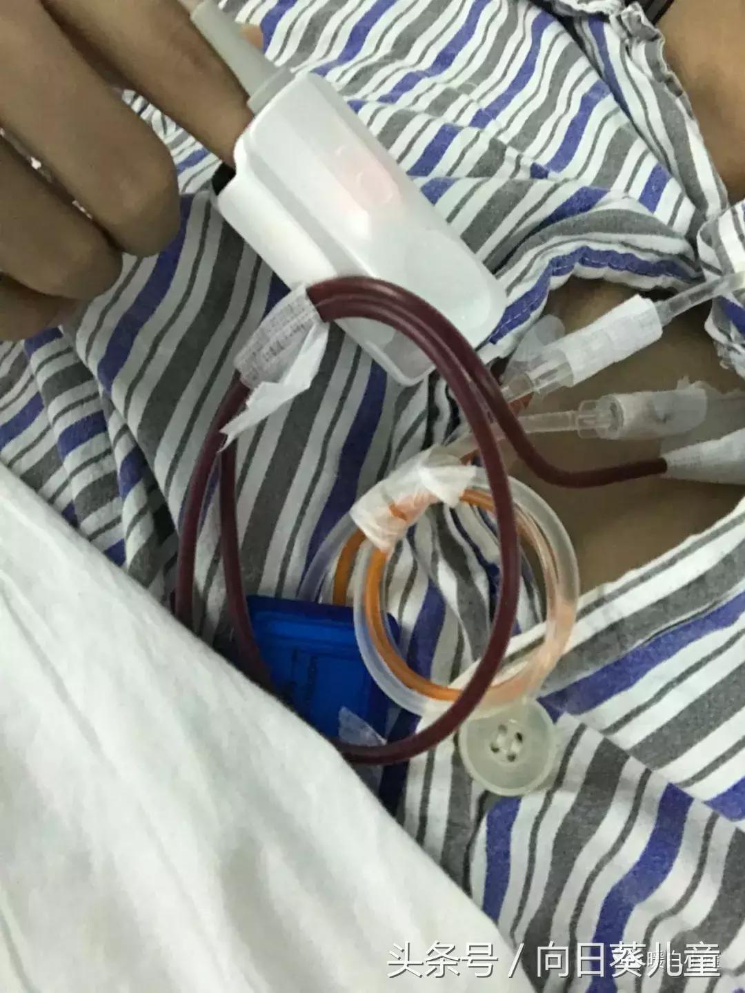 我是怎么患上白血病的自述,我得了白血病怎么办