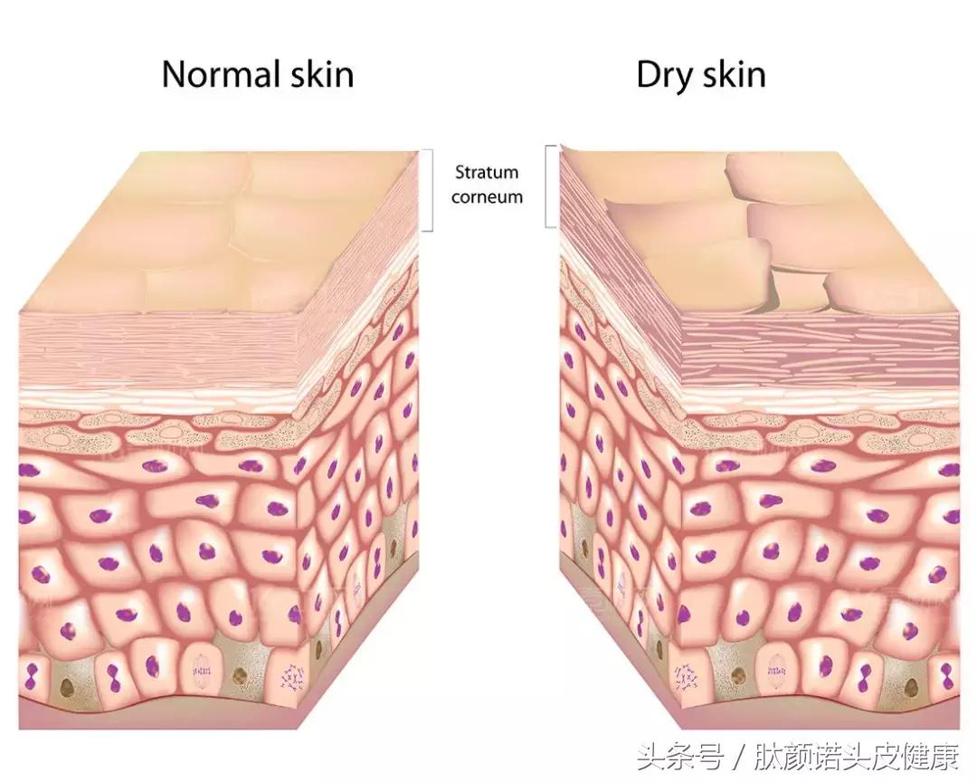 15岁女孩如何护肤,15岁女生夜间护肤
