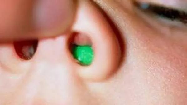 儿童口腔不良习惯的危害和防治,小孩嘴巴臭臭的是消化不良吗