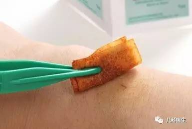 碘伏消毒伤口会留下色素沉淀吗,碘伏消毒伤口会留下色素沉着吗