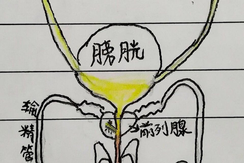 引起血尿的疾病及发病机制,引起血尿的原因有哪些