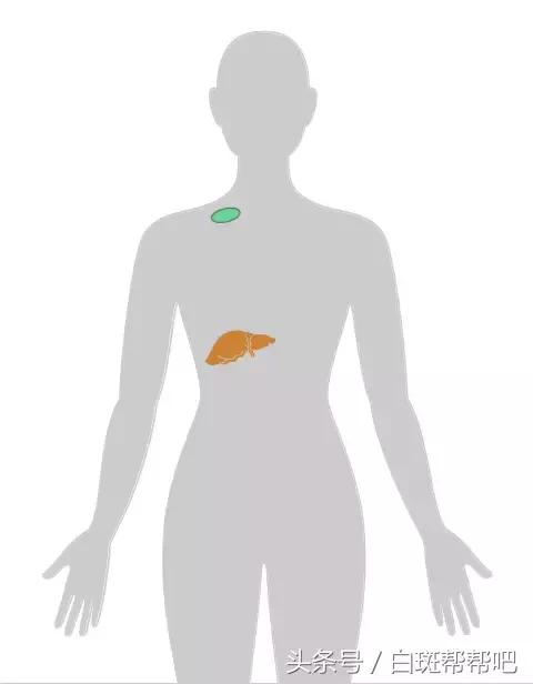 李咏是因为癌症死亡的吗,李咏得的啥癌症为什么葬在美国