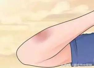 红药水和碘酒有什么区别,碘酒加红药水禁忌图片