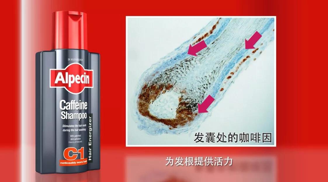 各种类型脱发真实脱发图片,为什么有些人脱发从头顶开始脱