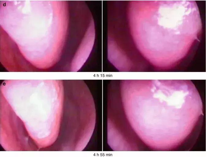 感冒鼻塞一边堵一边通怎么回事,为什么鼻塞的时候经常堵一边