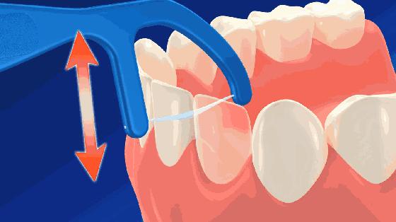 牙线的正确使用方法视频动画片,水牙线正确使用方法视频