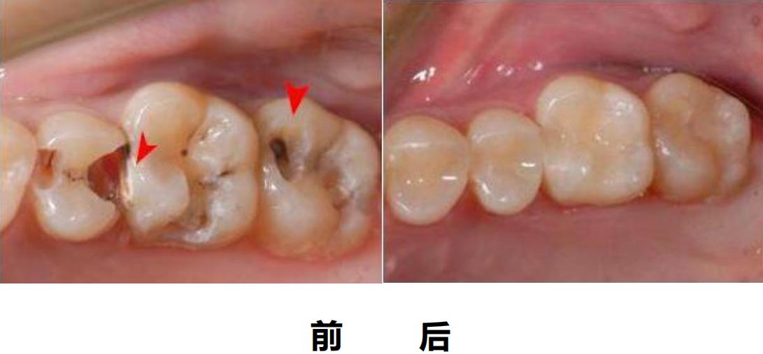 口腔门诊的十大优点,带你深入了解手术