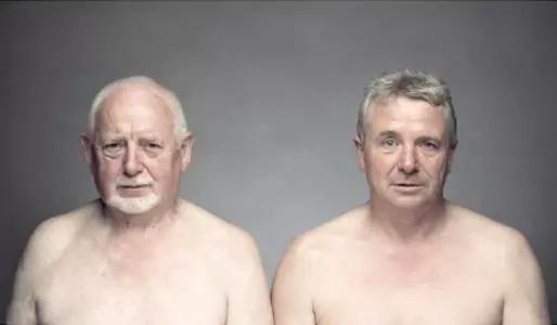 如何避免银屑病遗传下一代,银屑病遗传概率有多大