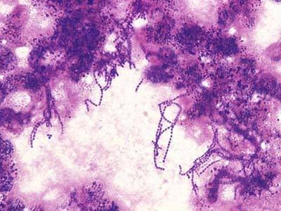 被猪骨头刺伤出血要紧吗,被猪骨头刮伤要吃消炎药吗