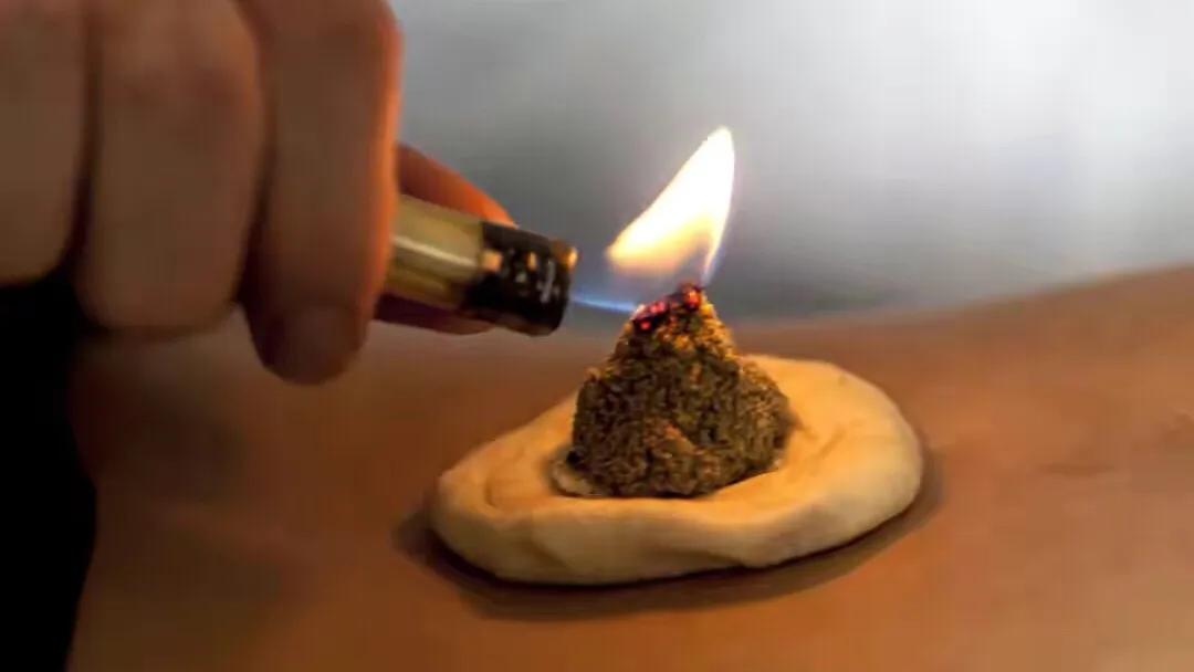 针灸治疗痛经的临床经验