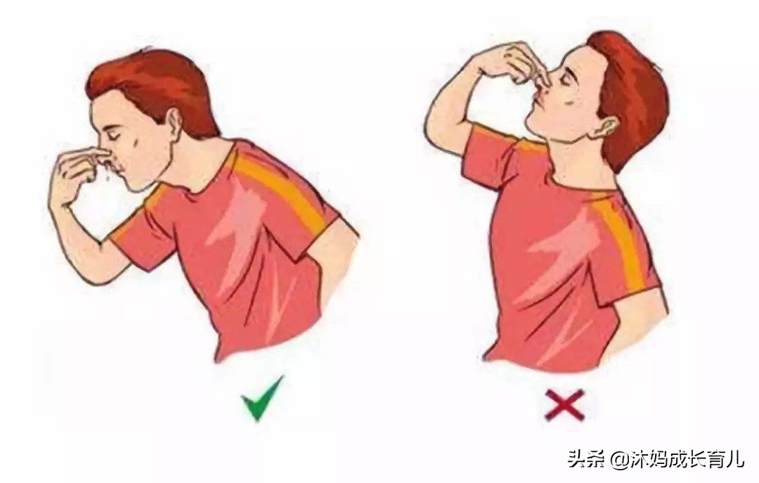 流鼻血了可以用卫生纸堵住吗,流鼻血用干卫生纸塞还是湿纸巾塞