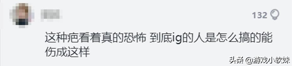 loltheshy细节,theshy手伤最新图片