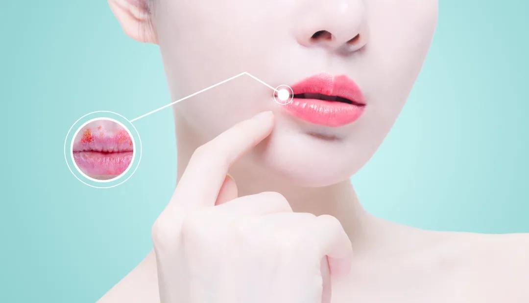 口腔溃疡维生素b2买什么样的,嘴唇干裂和口腔溃疡吃维生素b2