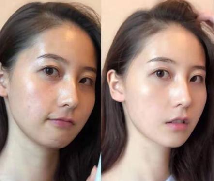 19岁女生打“美容针”脸肿得像包子，到医院检查，医生怒斥：无知