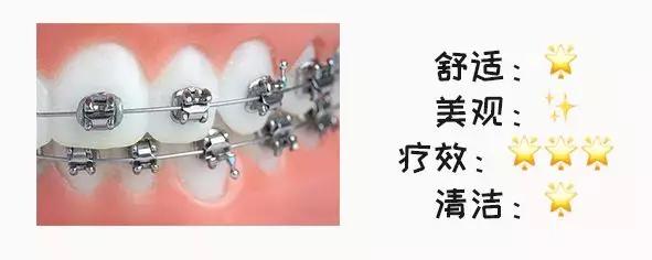 牙套价格表哪种牙套简单又好,最便宜的牙套是哪种牙套