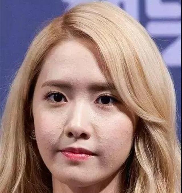 脸上挤出的小白粒是螨虫吗,挤出来的小米粒有螨虫吗