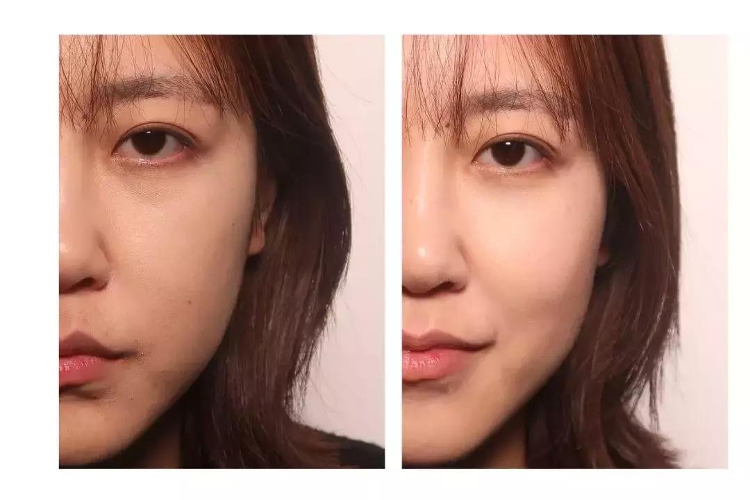 缇庡鐨偆绠＄悊鍖栧,缇庡闄㈠仛鑲岃偆閬憰