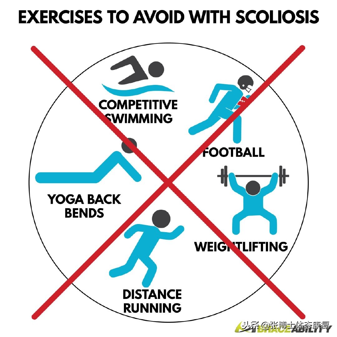 关于脊柱侧弯的原因,脊柱侧弯的介绍