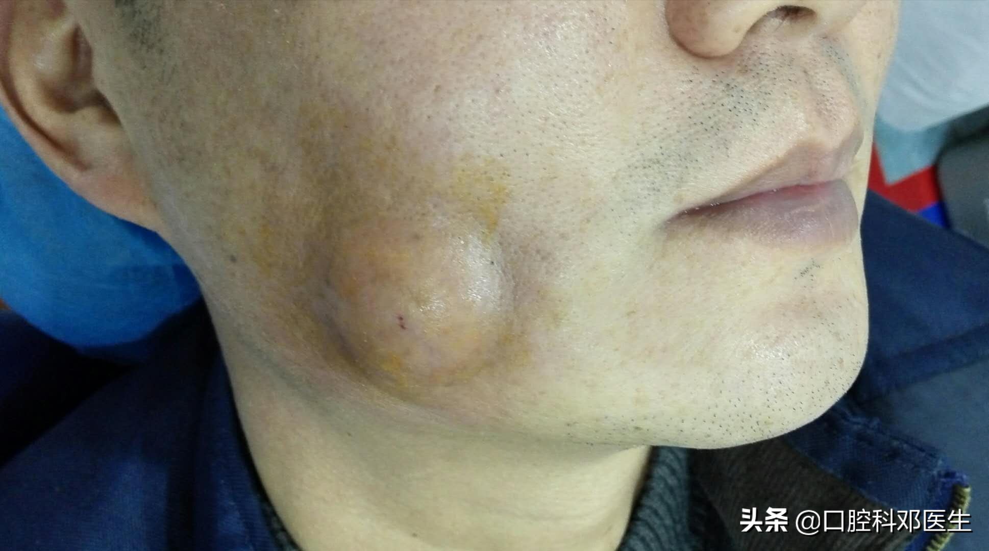 别让一张嘴毁了整张脸,别让一颗牙齿毁了一张脸