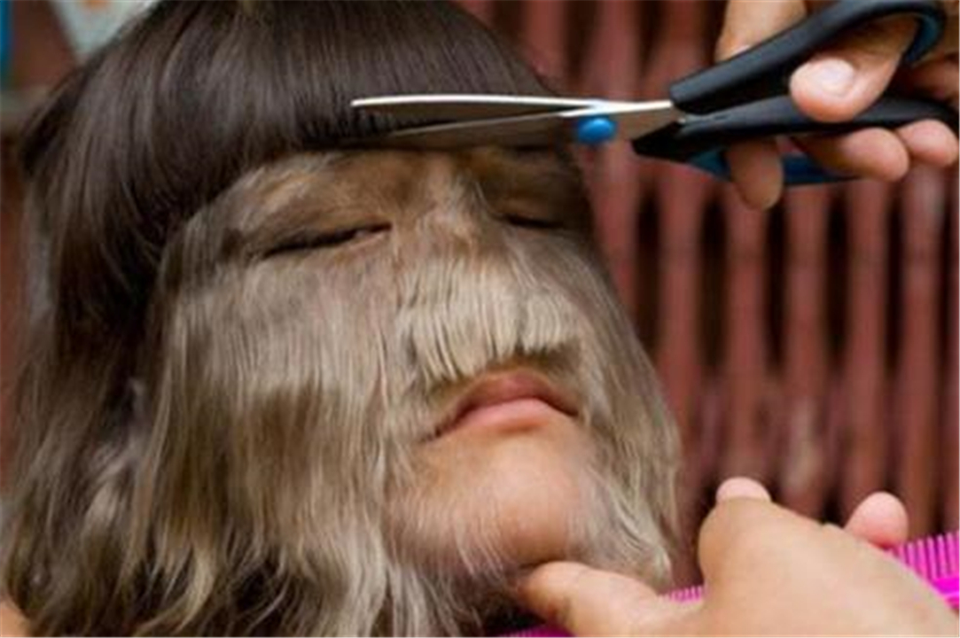 还记得狼人女孩吗？现在为结婚剃去毛发，网友：终于看清脸了