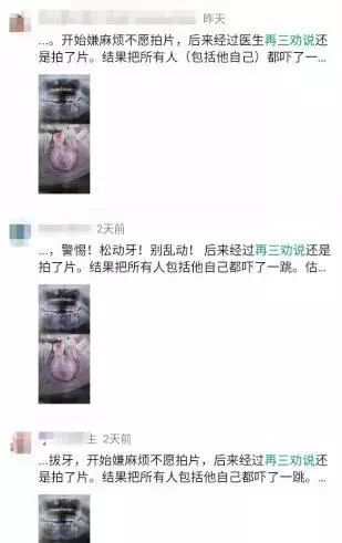 牙医警示看牙第一步为什么要拍片,牙医看牙片可以看出什么