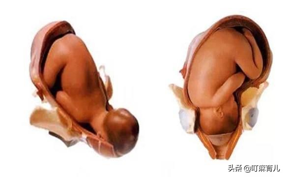 孕晚期胎动突然减少是什么原因,孕晚期肚子发紧发硬疼胎动减少