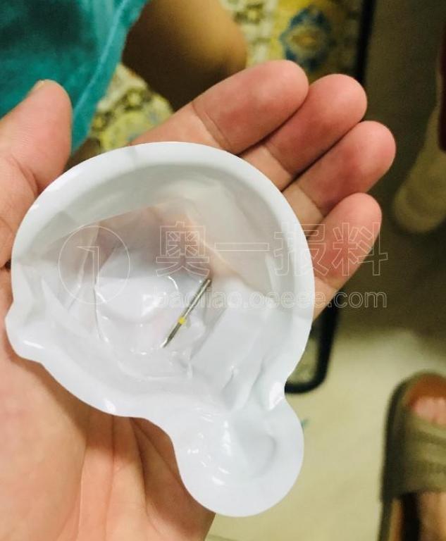男子补牙时，一根2.6厘米“钢针”掉进胃里，牙科：这是概率问题