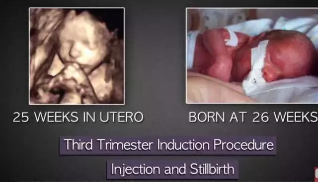 丁嘉丽明星的故事,丁嘉丽央视